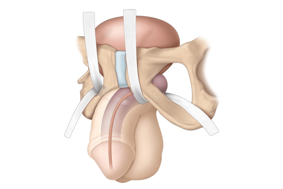 locations being investigated for the presence of filler