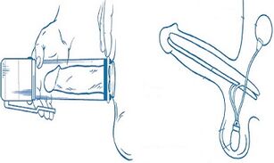 the pump principle for penis enlargement