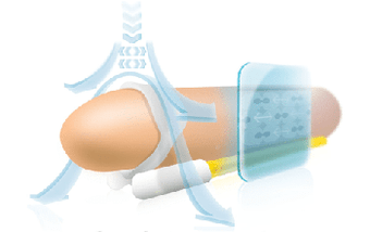 The operating principle of the extender to lengthen the phallus in length