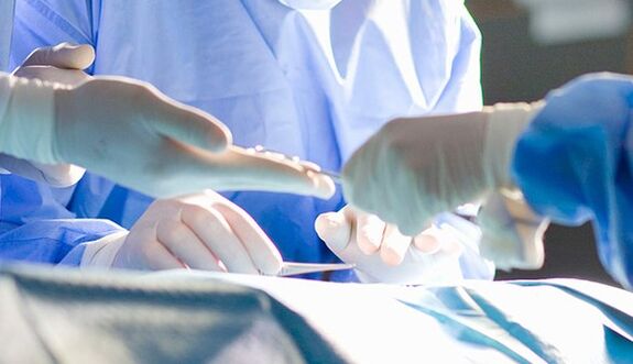 Surgery