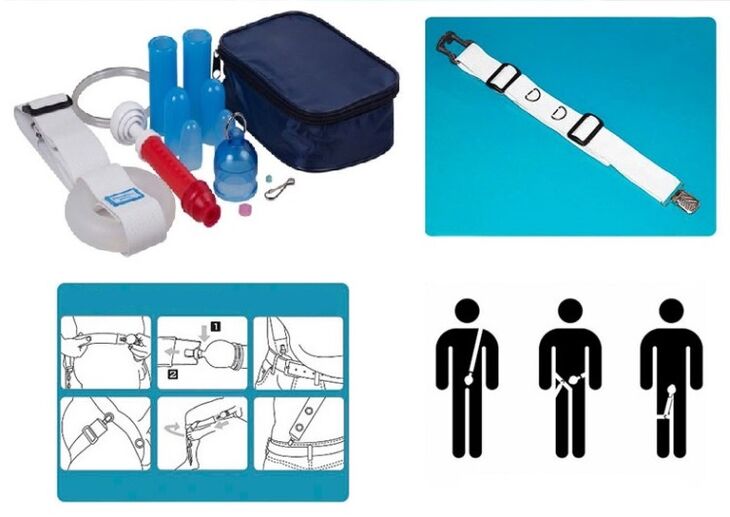 Stretching and Enlargement of the Penis Can Be Achieved With a Stretcher